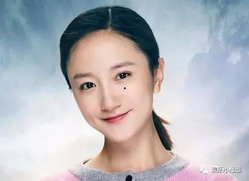 嘴上痣明星,嘴上痣明星的独特魅力